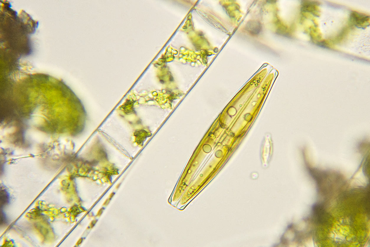 Micrograph of dividing Pinnularia diatoms
